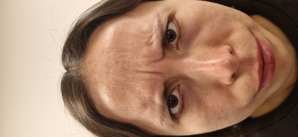 Antes — entrecejo y patas de gallo marcadas