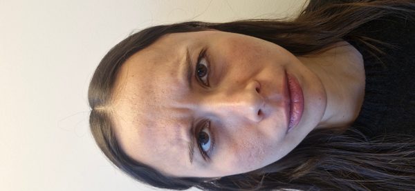 Después — rostro descansado y natural